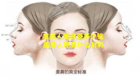 虞美人隆鼻要多少钱 虞美人隆鼻什么材料